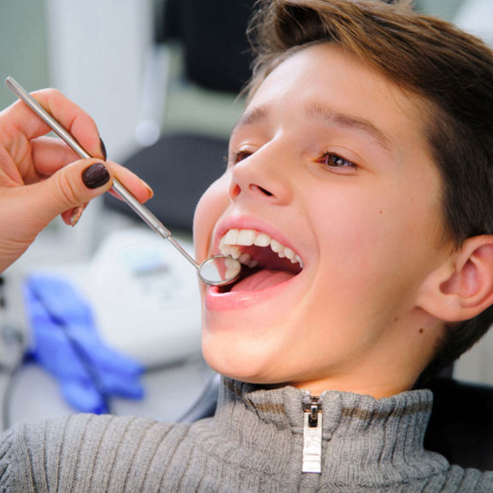 Fluoride Treatment