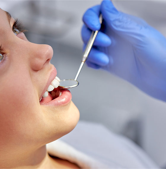 Dental sealants