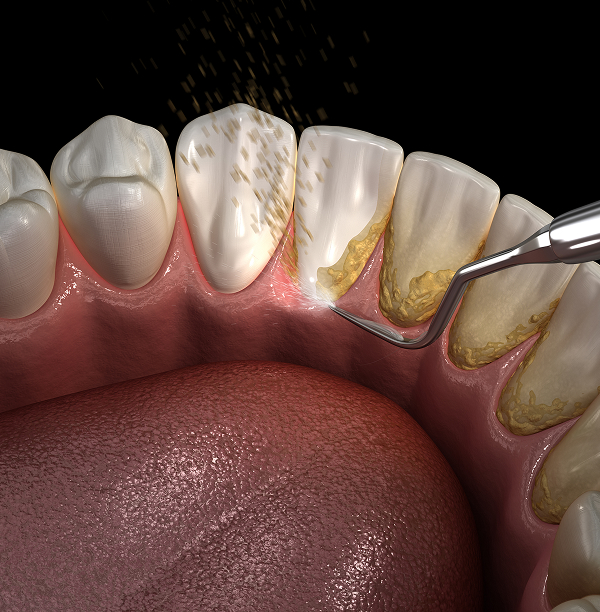 For Gums That Need a Little Extra Care
