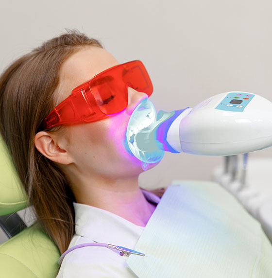 Teeth Whitening