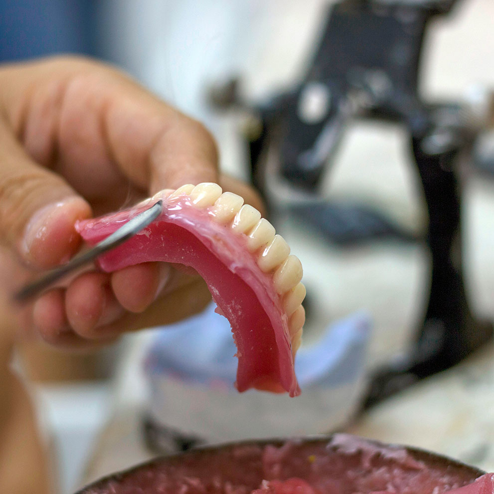Full Mouth Reconstruction